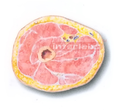 HUMAN TRANSVERSE SECTION MODEL THROUGH THE PROXIMAL 1/3 OF THE RIGHT THIGH (A)